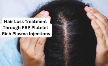 Hair loss treatment through prp platelet rich plasma injections
