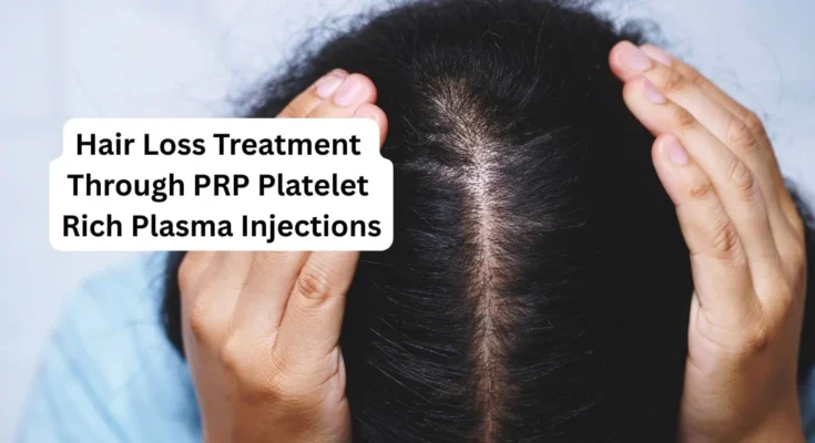 Hair loss treatment through prp platelet rich plasma injections