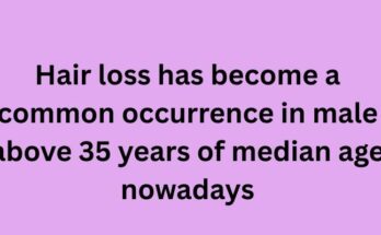 Hair loss has become a common occurrence in male above 35 years of median age nowadays