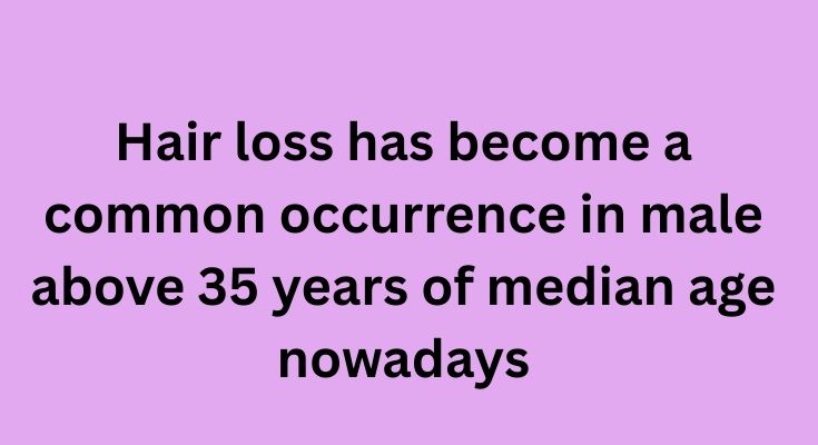 Hair loss has become a common occurrence in male above 35 years of median age nowadays